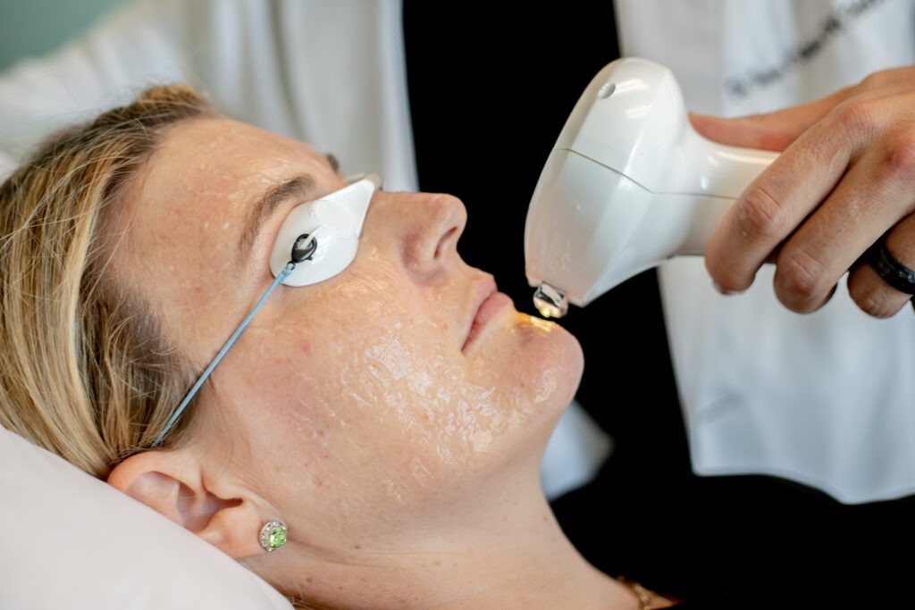 A person lying down receives a facial treatment using a handheld device. They wear protective goggles, and a gel is applied to their face. A practitioner in a white coat administers the procedure.